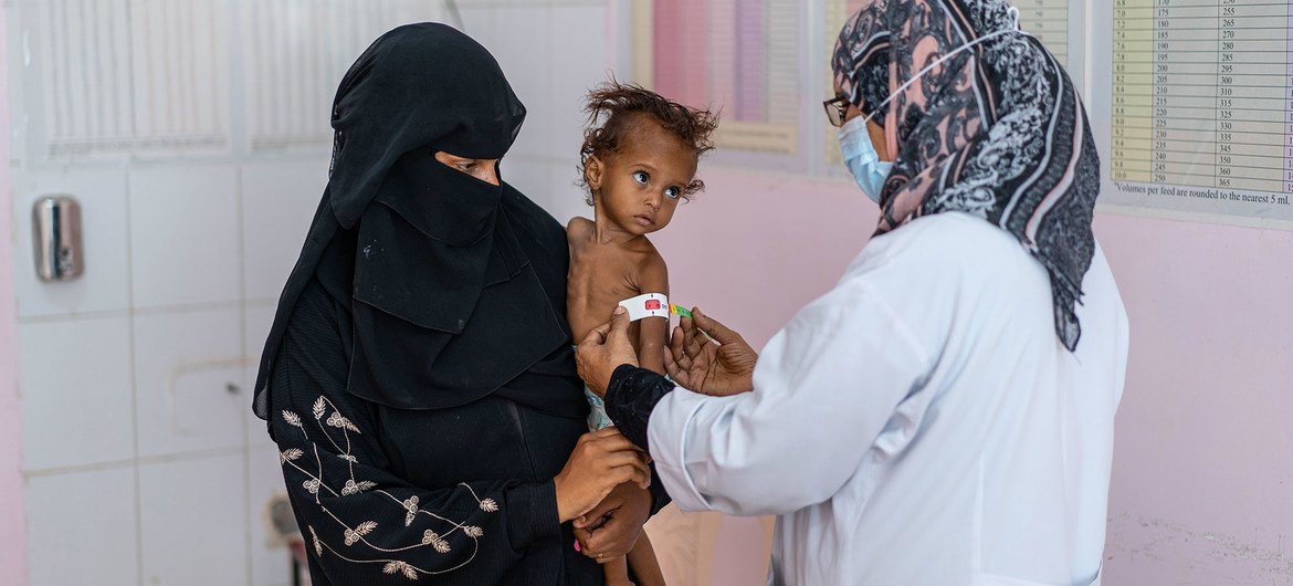 A one-and-a-half year-old girl is treated for malnutrition at a hospital in Yemen. A one-and-a-half year-old girl is treated for malnutrition at a hospital in Yemen.