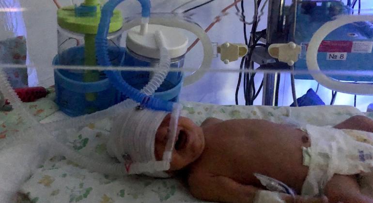 A baby receives respiratory support at a neonatal clinic in Ukraine. A baby receives respiratory support at a neonatal clinic in Ukraine.