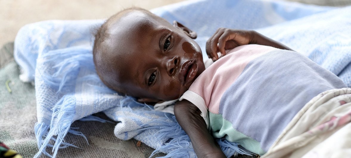 The 8-month-old boy is being treated for severe malnutrition at Al Sabbah Children's Hospital in Juba, South Sudan.  (2018)