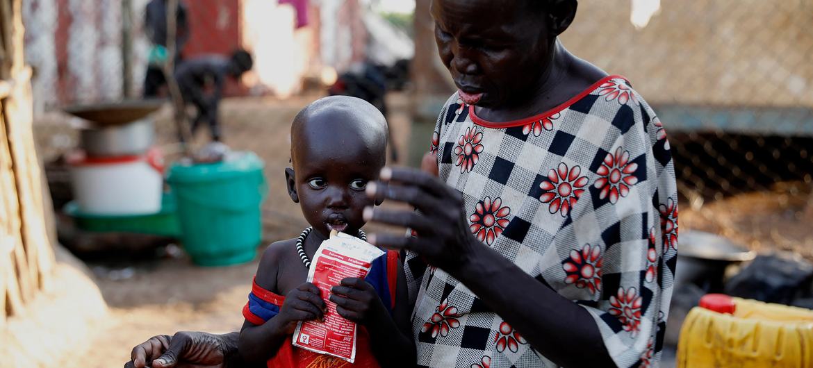 A grandmother takes care of her 17-month-old malnourished grandson in South Sudan. A grandmother takes care of her 17-month-old malnourished grandson in South Sudan.