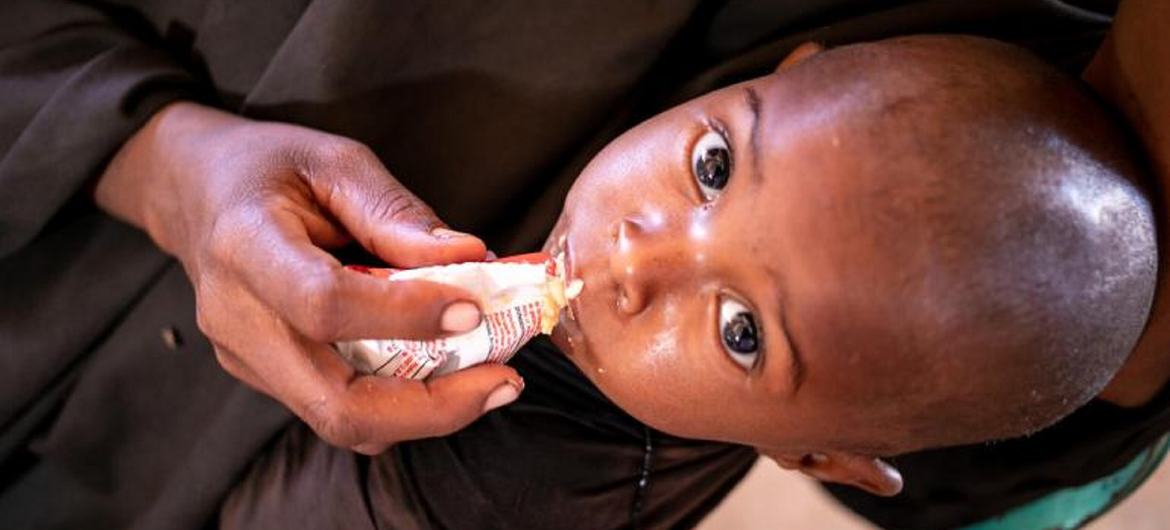 UNICEF Somalia provides nutritional intervention services to malnourished children. UNICEF Somalia provides nutritional intervention services to malnourished children.