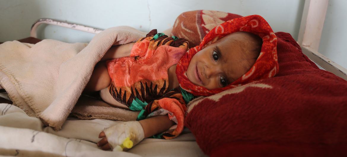 An 18-month-old in Afghanistan suffers from severe acute malnutrition with medical complications. An 18-month-old in Afghanistan suffers from severe acute malnutrition with medical complications.