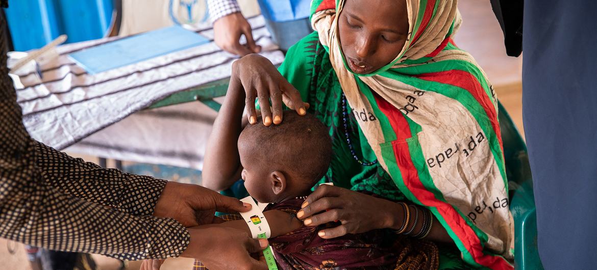 A one-year-old girl is treated for malnutrition at a WFP-funded clinic in Dolow in Somalia. A one-year-old girl is treated for malnutrition at a WFP-funded clinic in Dolow in Somalia.