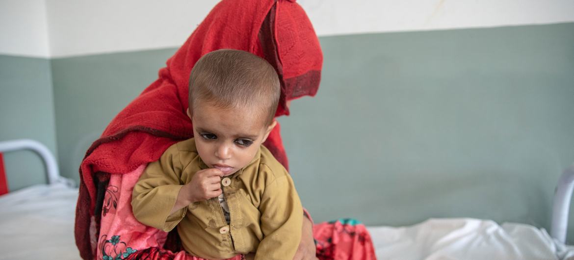 Afganistan'ın Kunar Eyaletindeki bir hastanede, bir anne ve iki yaşındaki oğlu, yetersiz beslenme nedeniyle tedavi altına alındı.