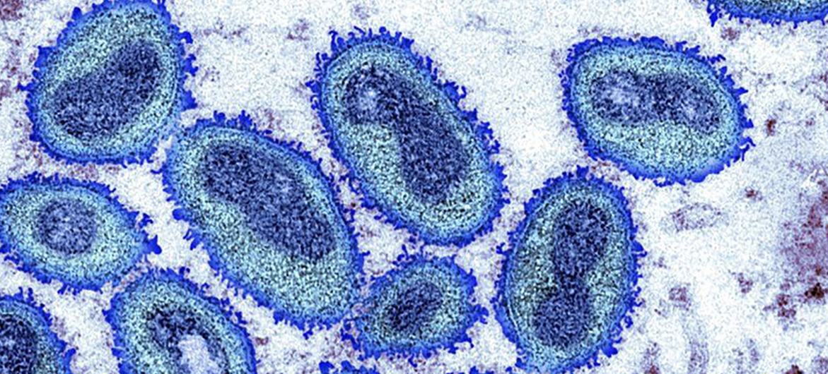 Monkeypox, a virus first discovered in monkeys in 1958 and that spread to humans in 1970, is now being seen in small but rising numbers in Western Europe and North America. Monkeypox, a virus first discovered in monkeys in 1958 and that spread to humans in 1970, is now being seen in small but rising numbers in Western Europe and North America.