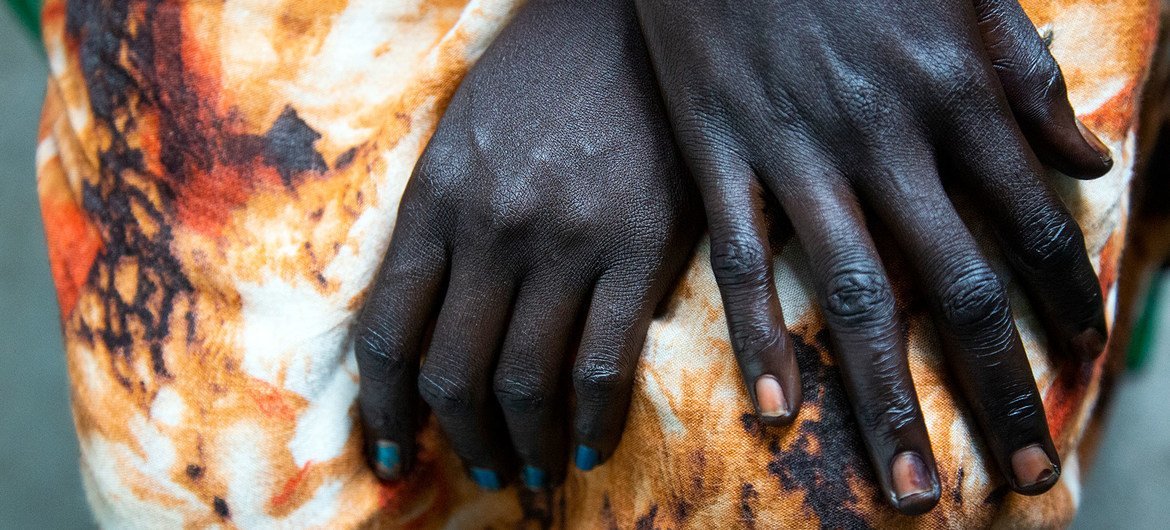 A South-Sudanese woman who was beaten by her husband seeks refuge in her brother’s house.