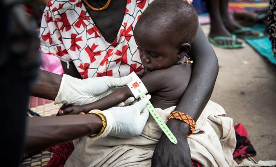 A child is being screened in a clinic in South Sudan A child is being screened in a clinic in South Sudan